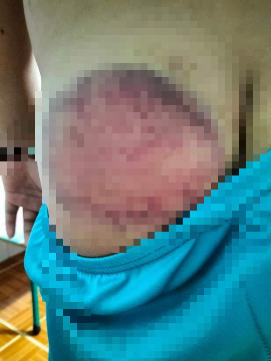 Tạm đình chỉ giáo viên đánh bầm dập mông học sinh - Ảnh 1.