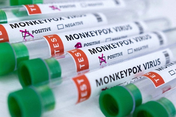 Bộ Y tế xếp đậu mùa khỉ vào bệnh truyền nhiễm nhóm B-1
