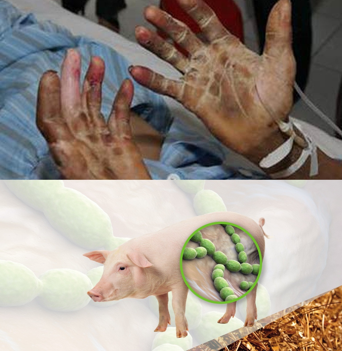 Bộ Y tế cảnh báo về căn bệnh nguy hiểm lây từ lợn sang người - 1