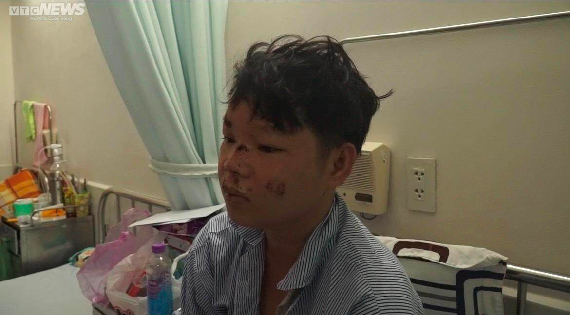 Lời kể của tài phụ vụ lật xe chở dưa ở Phú Yên khiến 9 người thương vong - 1