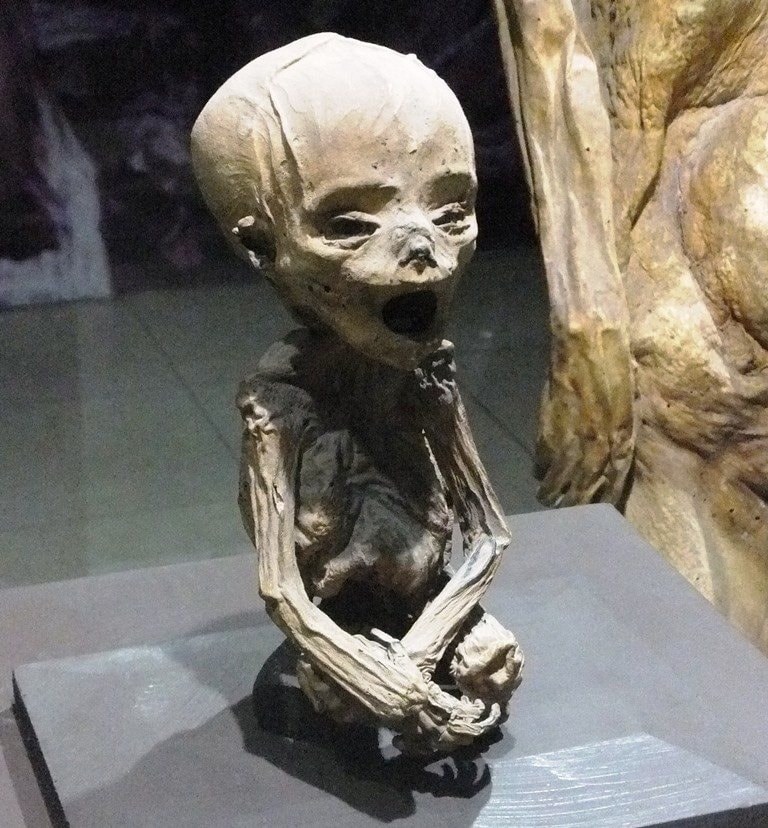 mummified-fetus-worlds-smallest-mummy.jpg