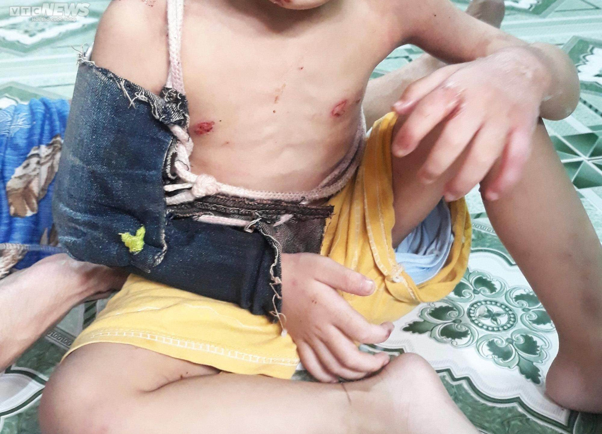 Người thân bé trai 2 tuổi ở TP.HCM từng chứng kiến bé bị cha đánh tàn bạo - 4
