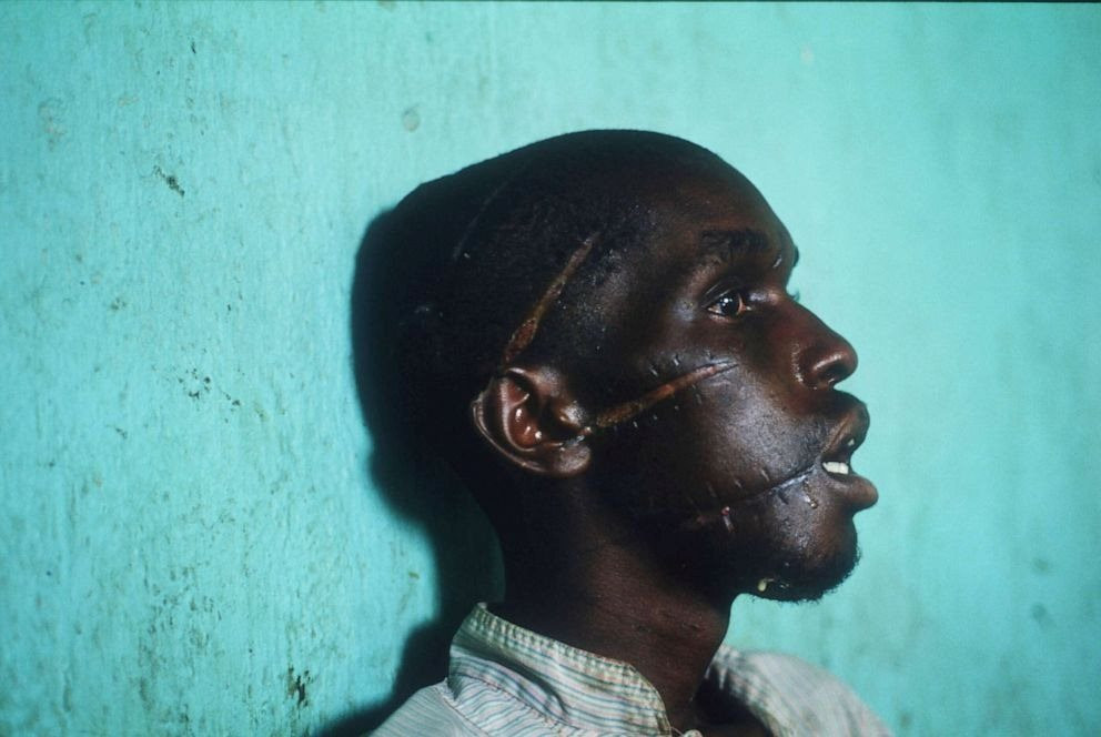 rwanda-genocide-anniversary-01-gty-jc-190405_hpembed_3x2_992_11zon.jpg
