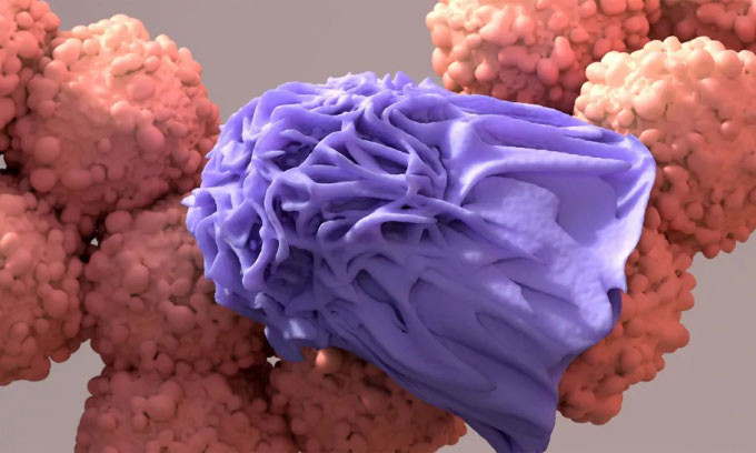  Thực bào, một loại tế bào miễn dịch, nuốt và tái chế các tế bào ung thư chết. 