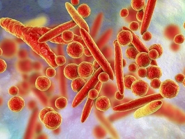 WHO bác thông tin về virus lạ gây triệu chứng ho ra máu ở Nga