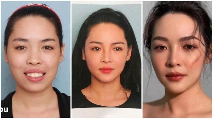 Sốc diện mạo hot girl thẩm mỹ Vũ Thanh Quỳnh sau màn đập mặt xây lại chấn động MXH
