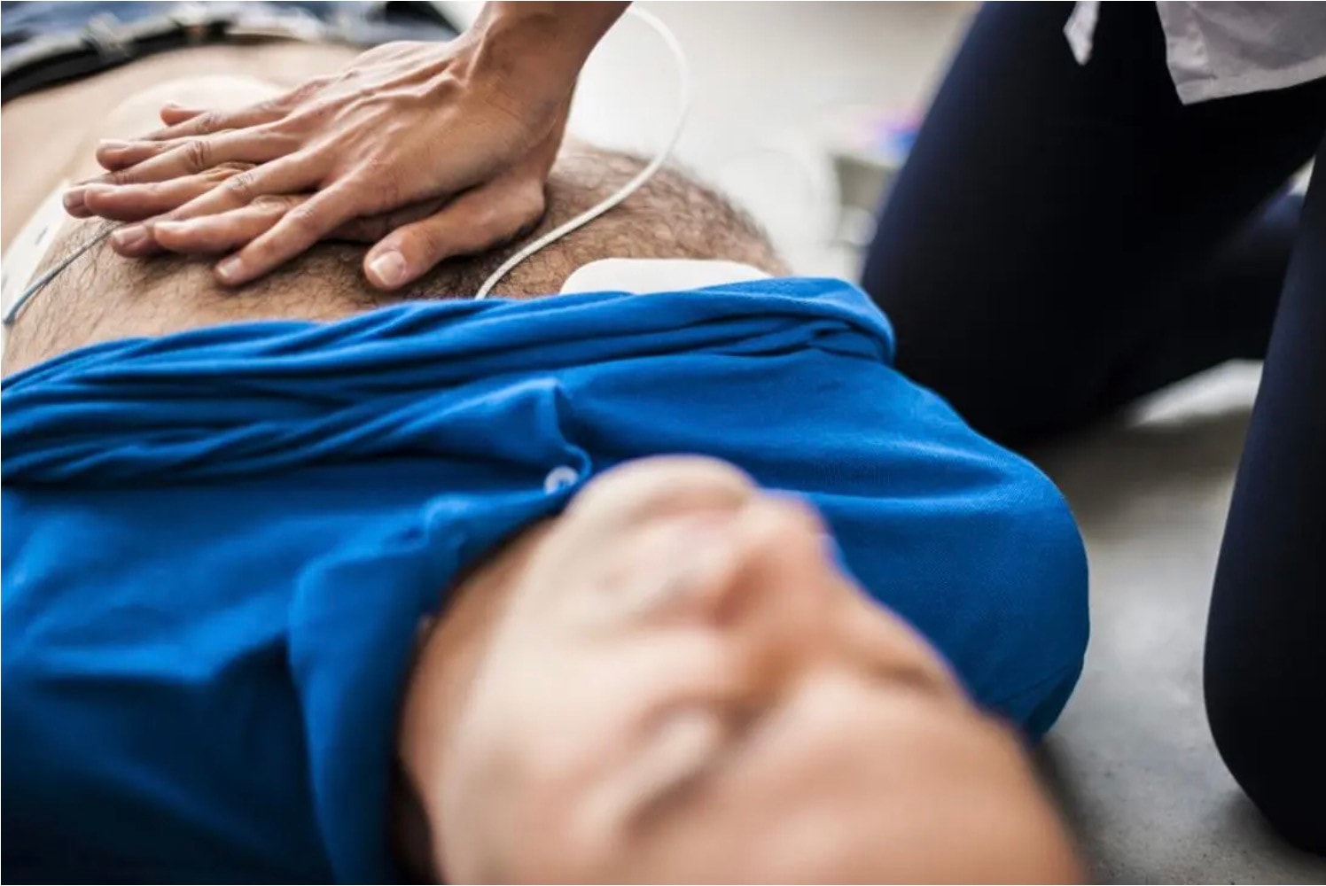 hồi sức tim phổi - Medical News