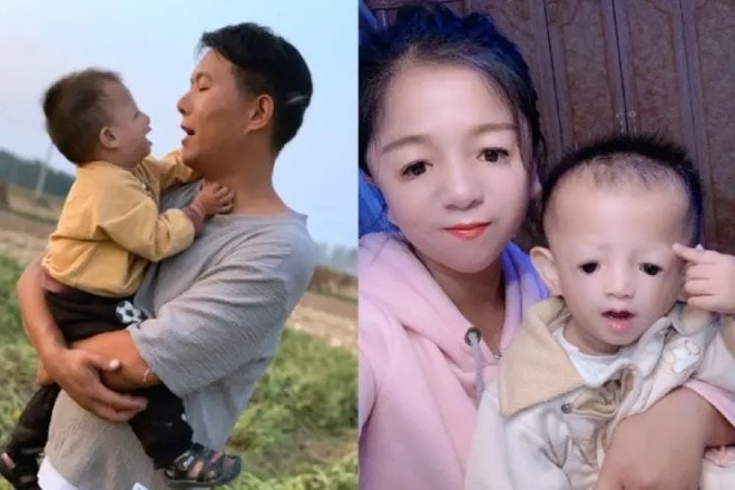 Cô gái 'mặt chim' từng bị xa lánh, giờ sống ra sao sau khi sinh 2 con