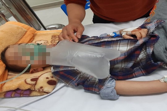 Bé trai nguy kịch khi uống nhầm thuốc cai nghiện vì tưởng là siro