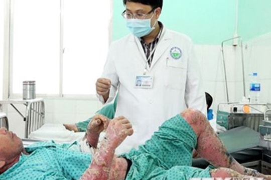 TPHCM: Tai biến nặng do tự mua thuốc trên mạng chữa bệnh vảy nến