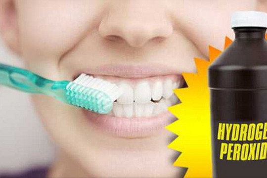 Học cách sử dụng hydrogen peroxide để làm trắng răng như trên Tik Tok: Chuyên gia khuyến cáo cần hết sức cẩn trọng!
