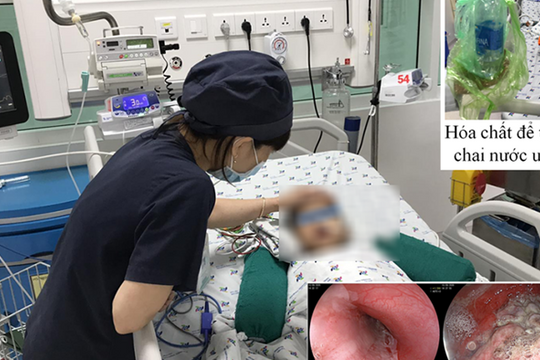 Khát nước khi đi chơi về, bé trai uống nhầm hóa chất chống thấm