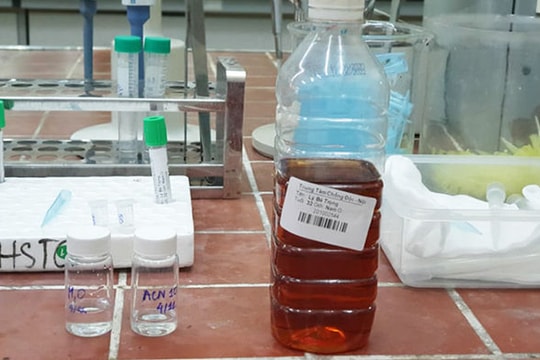 Sau uống rượu với thịt chó, chàng trai bị tổn thương não nặng