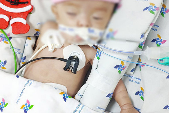 Vừa xuất viện về nhà, em bé sinh non tháng phải nhập viện cấp cứu vì sặc sữa