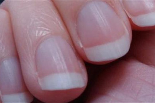 Người đàn ông bị ung thư phổi, bác sĩ chỉ 4 dấu hiệu trên tay cho thấy ung thư đã đến giai đoạn giữa và cuối