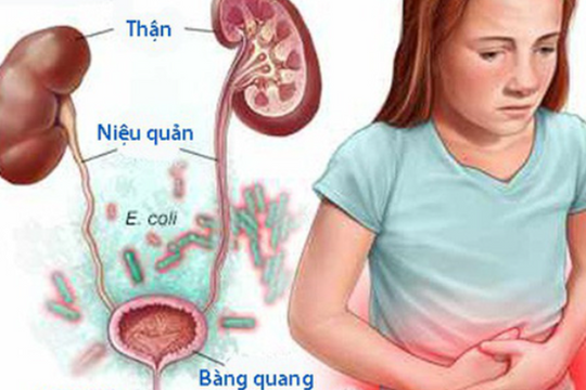 Bé gái 8 tuổi chảy máu vùng kín vì bị căn bệnh hiếm gặp