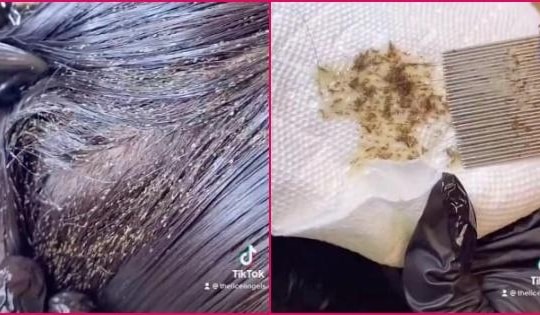 'Sởn da gà' kinh hãi với clip diệt tổ chấy nghìn con trên đầu bé gái