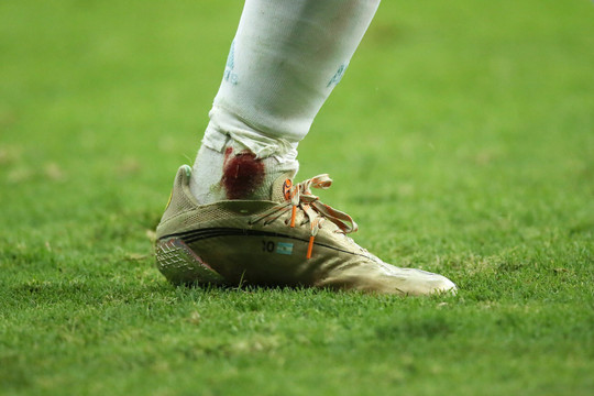 Messi thi đấu với mắt cá chân đầy máu trong trận thắng  Colombia 