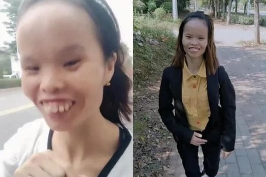 Người phụ nữ xấu nhất Tiktok giàu kếch xù, nhìn chồng và con gái mới kinh ngạc