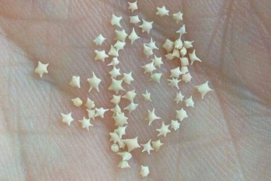 Bãi biển Nhật Bản có hạt cát hình ngôi sao trắng đẹp như truyện cổ tích