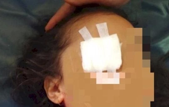 Rúng động: Bé gái bị người thân đè ra móc mắt để làm lễ cầu tài lộc