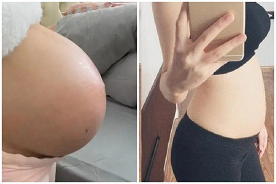 Cũng là mang thai, tại sao có người mang thai bụng to người lại bụng nhỏ? Bà bầu mà bụng nhỏ có ảnh hưởng đến sự phát triển của thai nhi không?