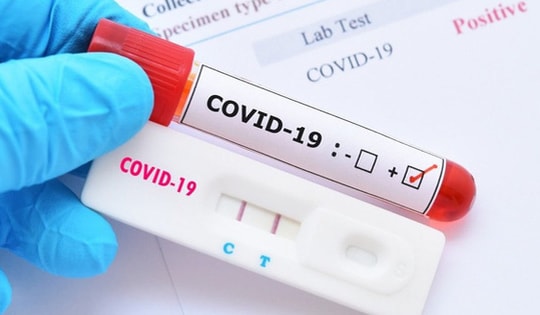 Bộ Y tế: Các địa phương lập đoàn kiểm tra việc kinh doanh test kit xét nghiệm nhanh và PCR