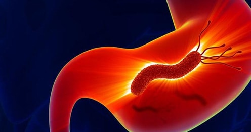 Nhiễm vi khuẩn Helicobacter pylori và nỗi lo ung thư dạ dày