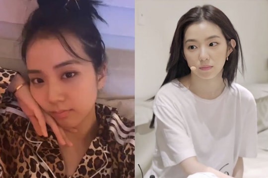 Đọ nhan sắc của 10 thành viên visual nhóm nữ Kpop khi để mặt mộc: Ai vẫn tỏa sáng mà không cần đến makeup?