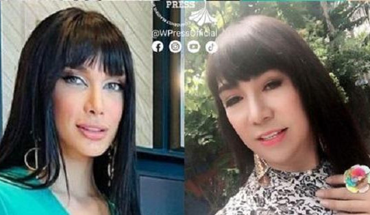 Hoa hậu Venezuela gây ngỡ ngàng vì quá giống Long Nhật