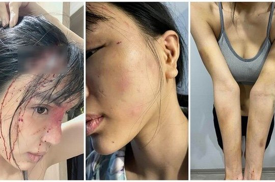 Vụ nữ siêu mẫu Khả Trang nghi bị giam lỏng và bạo hành dã man: Người chồng bị tố có thể phải đối mặt hình phạt nào?