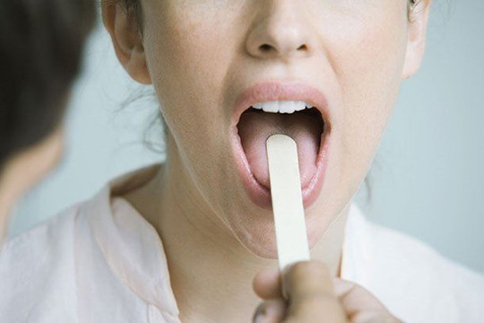 5 biểu hiện ở lưỡi cảnh báo bệnh