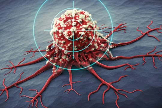 Phương pháp tấn công thẳng tế bào ung thư phổi giúp tăng hiệu quả điều trị