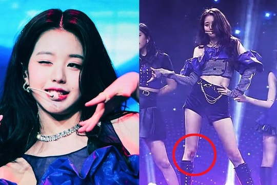 Jang Wonyoung (IVE) bị thương đến chảy máu mà vẫn phải tiếp tục trình diễn: Thái độ ra sao mà khiến Knet phải kinh ngạc?