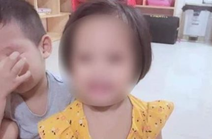 Bé 3 tuổi ở Hà Nội bị ghim đinh vào đầu vẫn chưa thể phẫu thuật