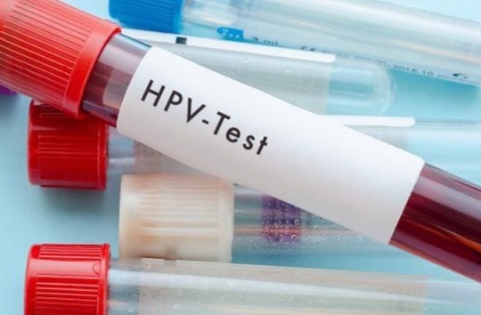 Dấu hiệu cơ thể nhiễm virus HPV