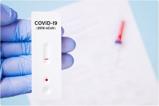 Lưu ý trước khi test nhanh Covid-19 để tránh kết quả sai lệch