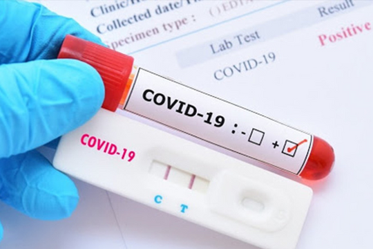 Chính phủ gia hạn thời gian thanh tra mua sắm kit xét nghiệm, vaccine COVID-19