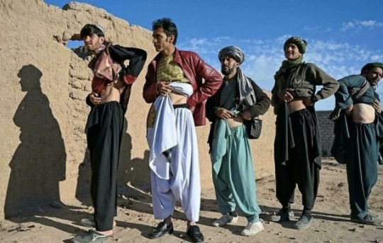 "Làng một quả thận" ở Afghanistan