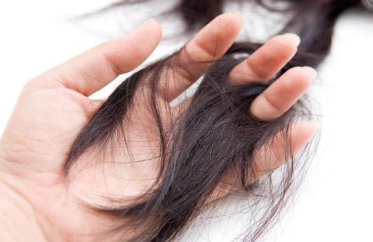 Rụng tóc sau khi mắc Covid-19 có nguy hiểm?