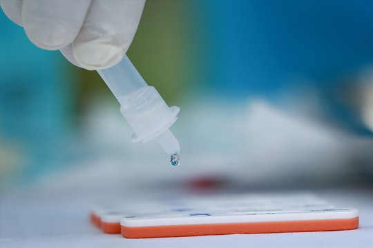 Bộ Y tế bãi bỏ 9 văn bản liên quan đến sinh phẩm xét nghiệm SARS-CoV-2