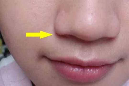5 nét tướng phụ nữ càng xấu chồng càng giàu to, phước 3 đời mới được lấy về làm vợ