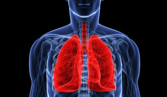 Ung thư phổi khó phát hiện sớm, cần chú ý 5 triệu chứng này