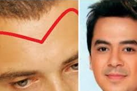 Nhìn trán biết số mệnh: 5 tướng trán "sướng từ trong trứng", ngồi mát ăn bát vàng, 2 kiểu làm mấy vẫn nghèo hèn