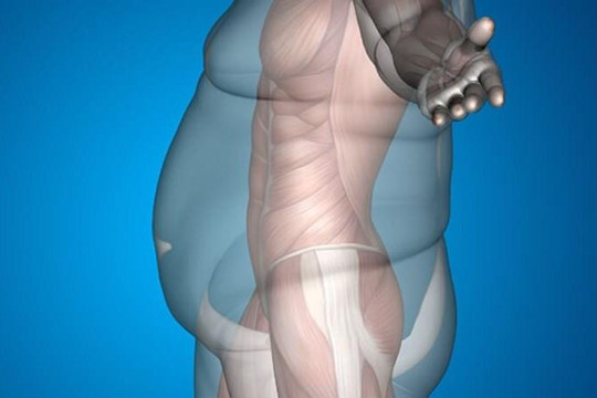 Tạng người dễ béo khó giảm cân nên làm gì để duy trì cân nặng hợp lý?