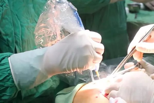 Quý bà mất mạng chỉ vì ham hố tân trang làm mới 'cô bé'