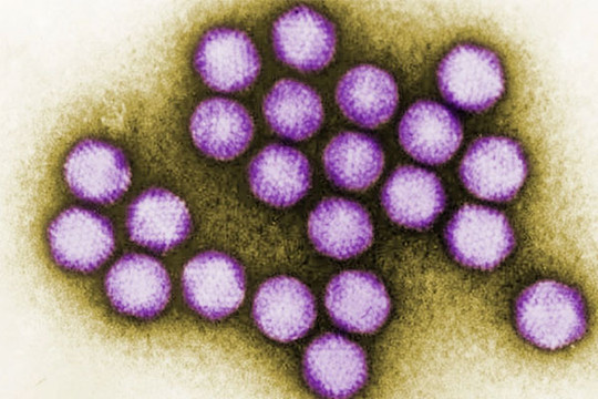 CDC Mỹ: Làn sóng viêm gan bí ẩn có thể không tồn tại
