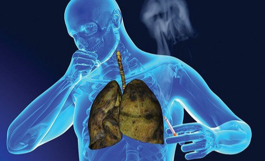Điều trị bệnh nhân ung thư phổi muộn bằng liệu pháp miễn dịch