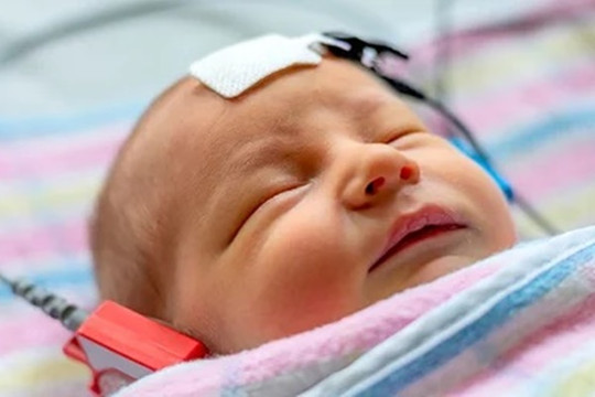 Nước tiểu và mồ hôi của trẻ sơ sinh có mùi khó chịu, mẹ đừng chủ quan bởi có thể con bị rối loạn chuyển hóa - căn bệnh gây tử vong rất cao