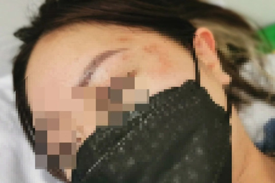 Cô gái trẻ tố bị người đàn ông sàm sỡ, hành hung ở Aeon Mall Long Biên